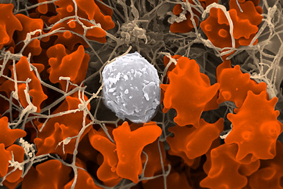 Eliquis (apixaban) Approved Eliquis (apixaban) approved in Europe for the prevention of venous thromboembolism (blood clots) in joint replacement patients; accepted for review in Europe and the U.S. for stroke prevention in patients with atrial fibrillation.