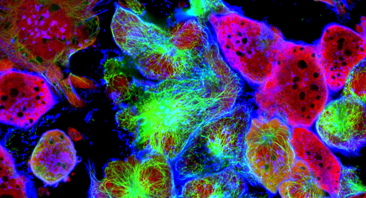 cancer-cells_gettyimages_1280x695.jpg