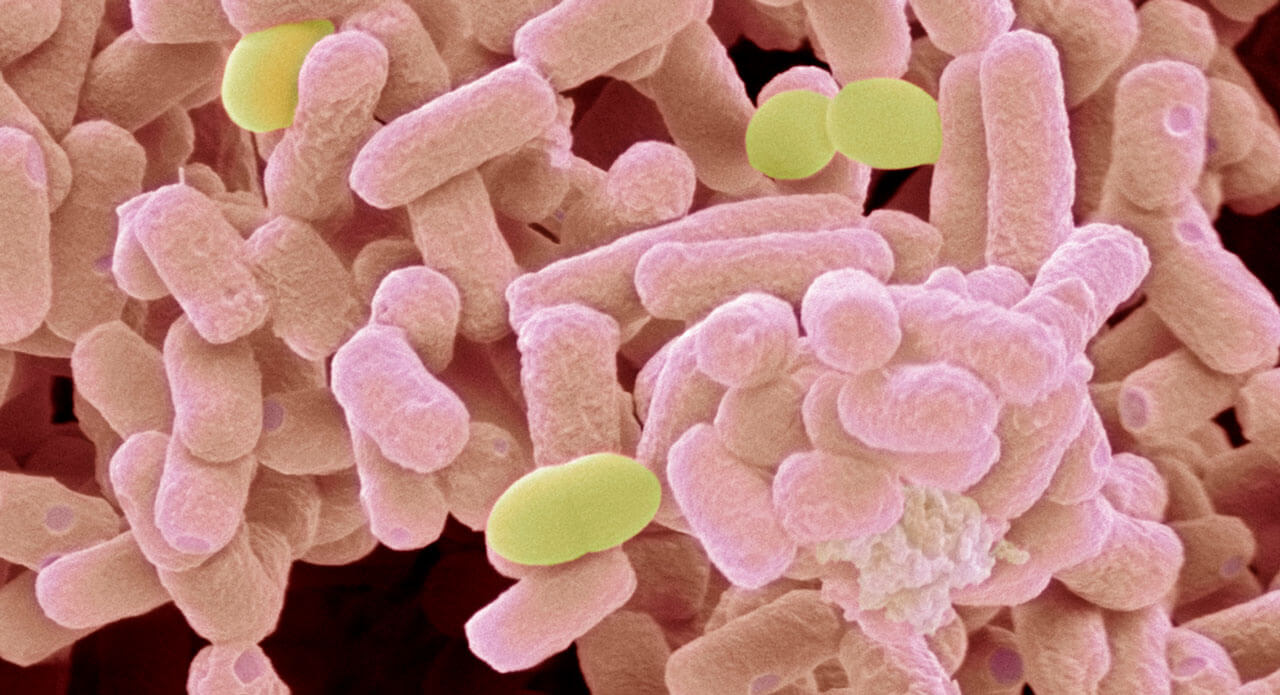 When Bacteria Outsmart Antibiotics, Surveillance Can Help Battle Resistance