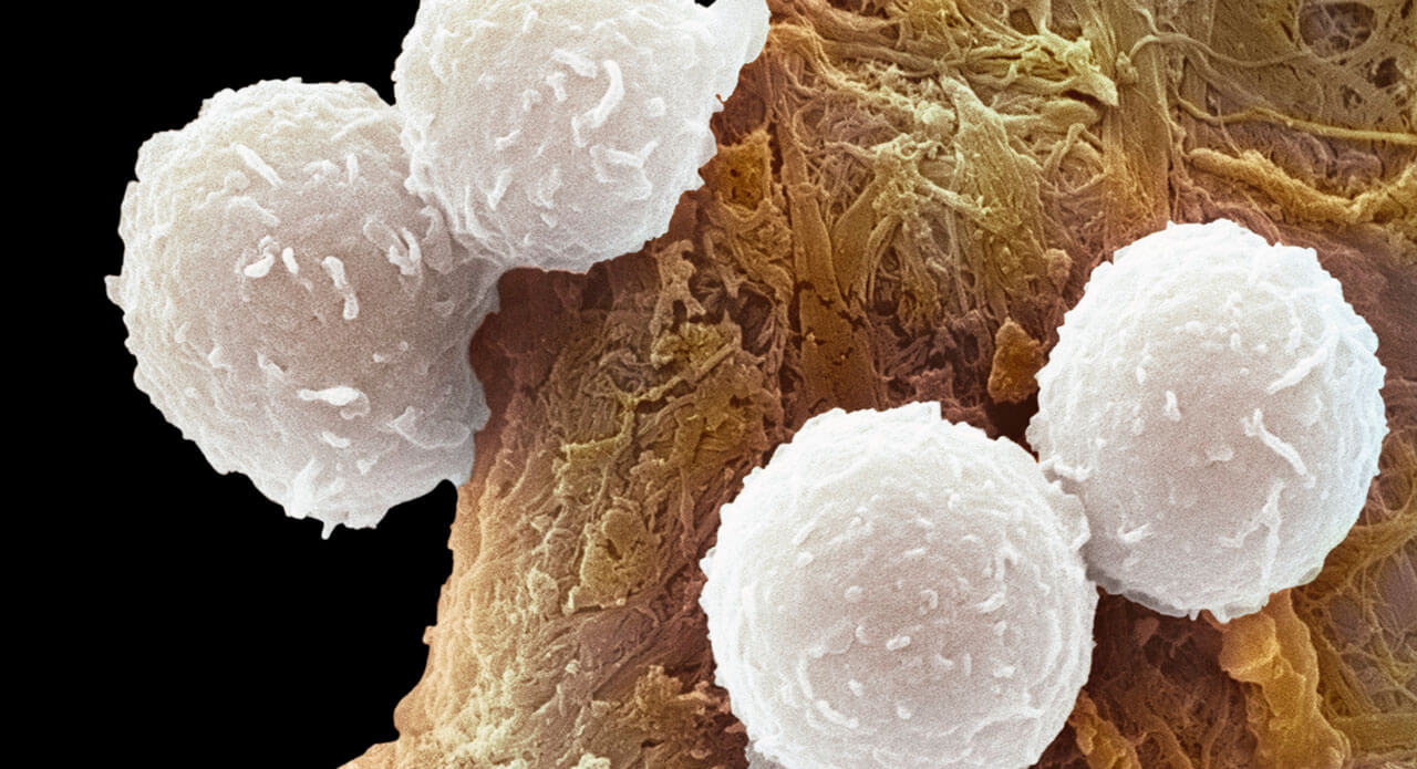 How Immuno-Oncology Taps Into the Body’s Own Immune System to Fight Cancer
