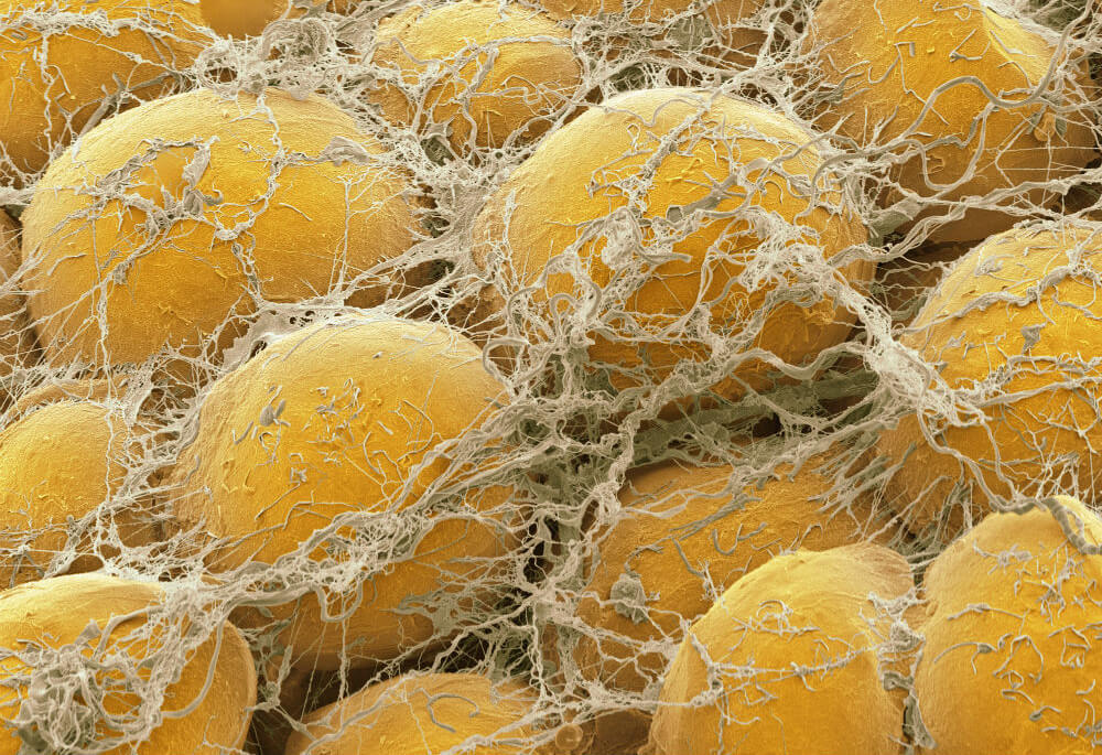 pfizer_get_science_fat_listicle_fat_cells_image.jpg