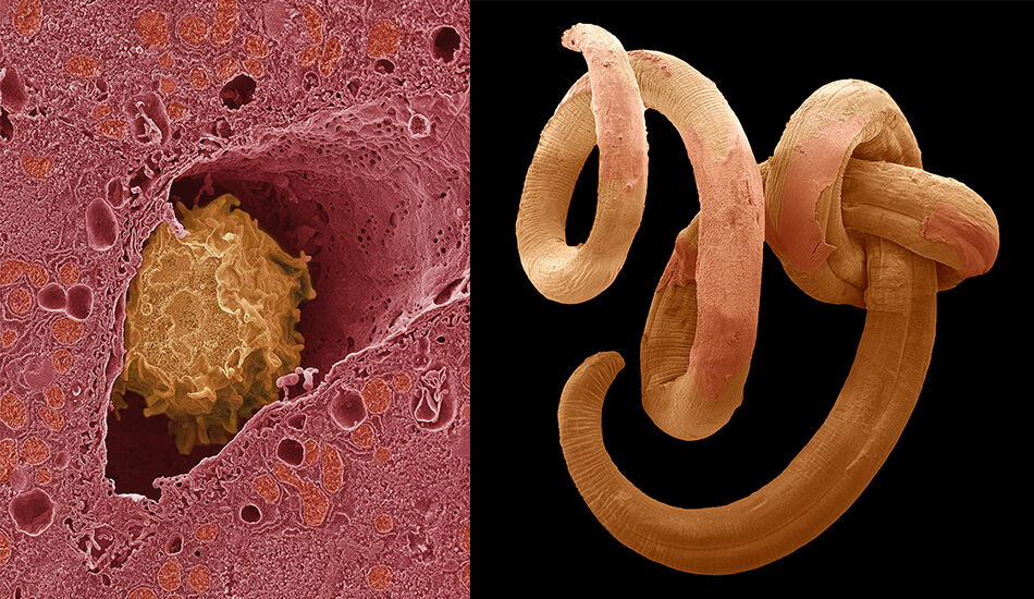 Good Guy/Bad Guy: Macrophages vs. Pinworms