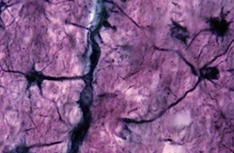 Microscope image of human brain with purple shading overlay
