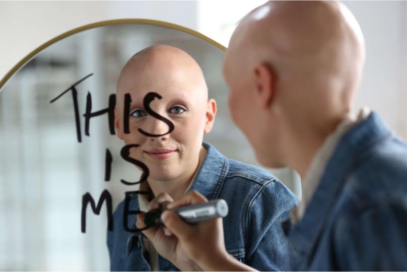Alopecia patient writing on mirror