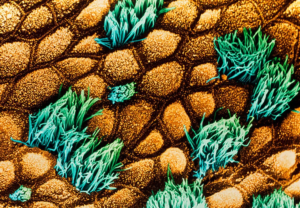 phenotypic drug discovery